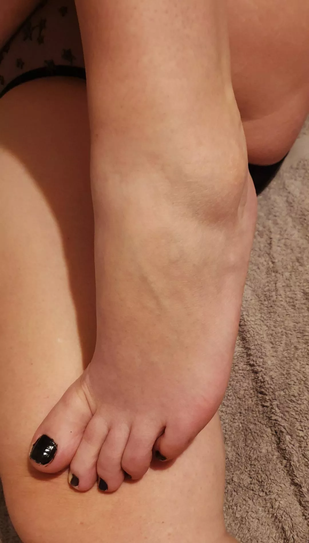 I think my feet could do with a little moisturising