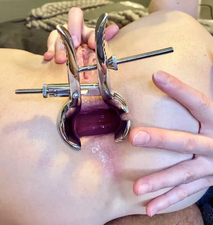 I was so gaped!