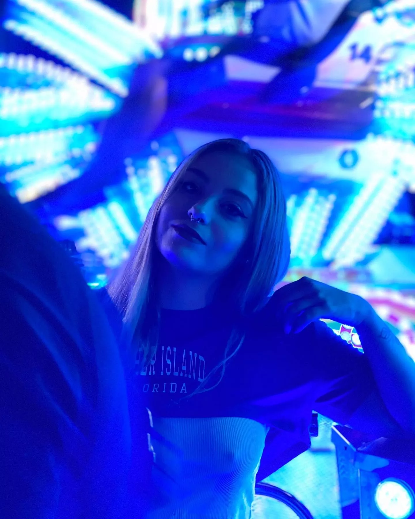 I would love to have surgery, can anyone help me???