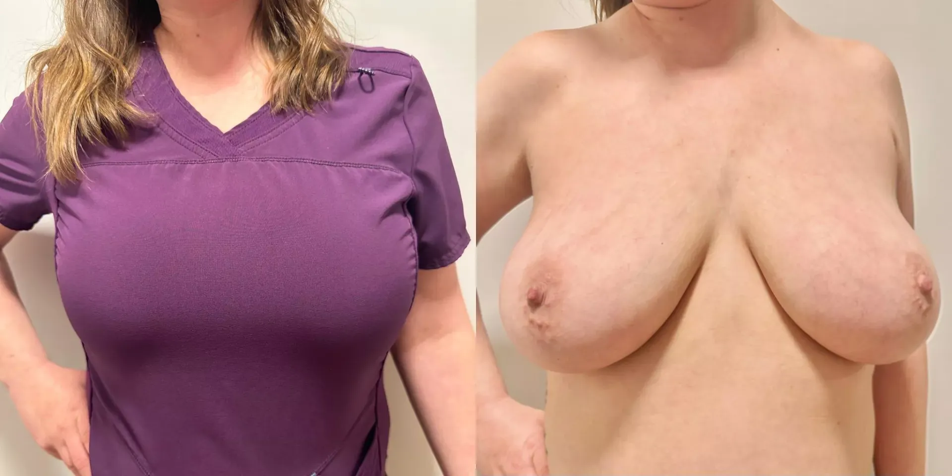 I’ll take your sample on my tits.☺️