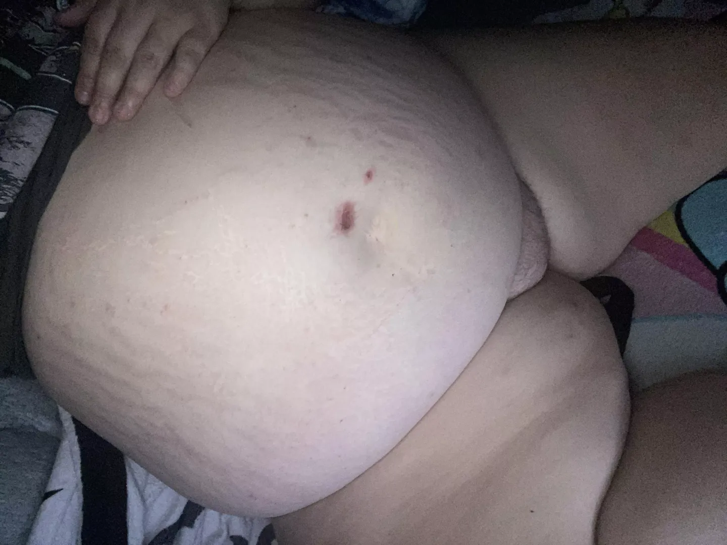 I’m so swollen 