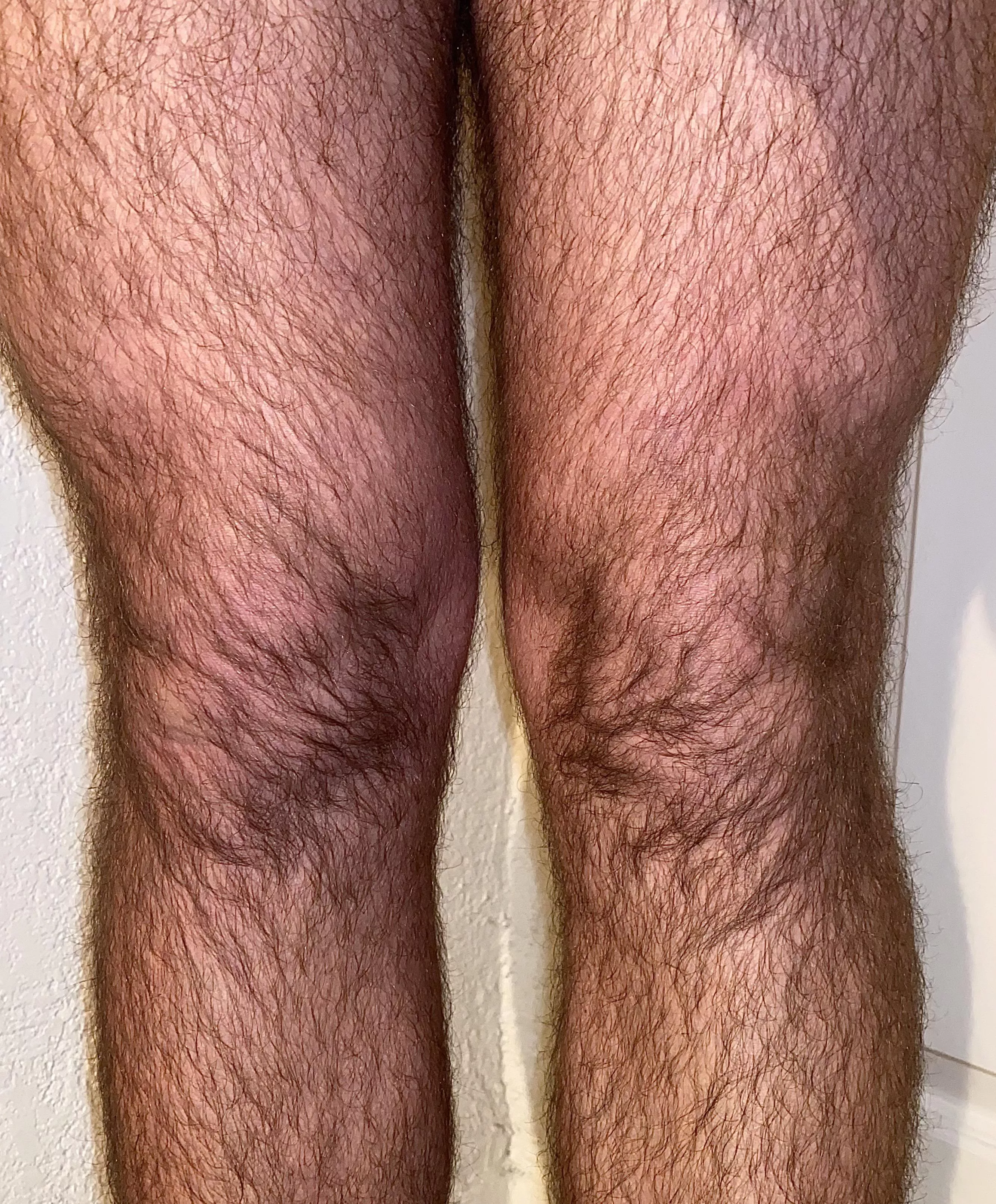 Insanely hairy knees