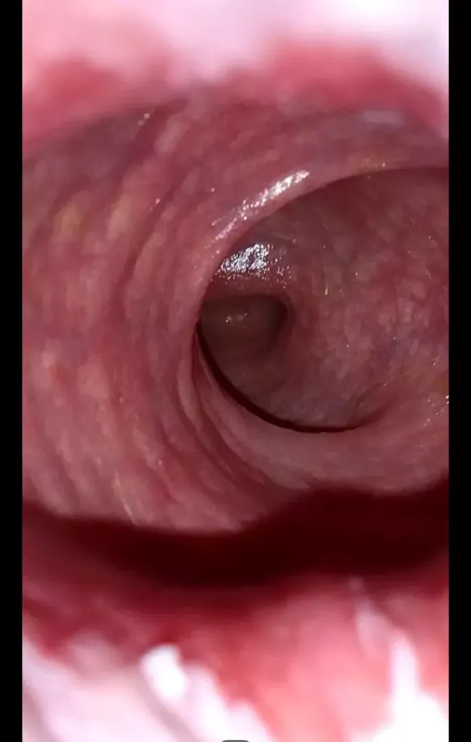 Inside my asshole 
