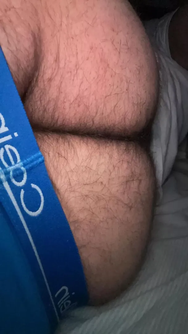Is it too hairy?