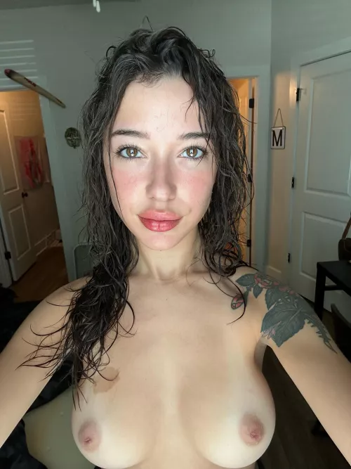 Is my birth mark a turn off?