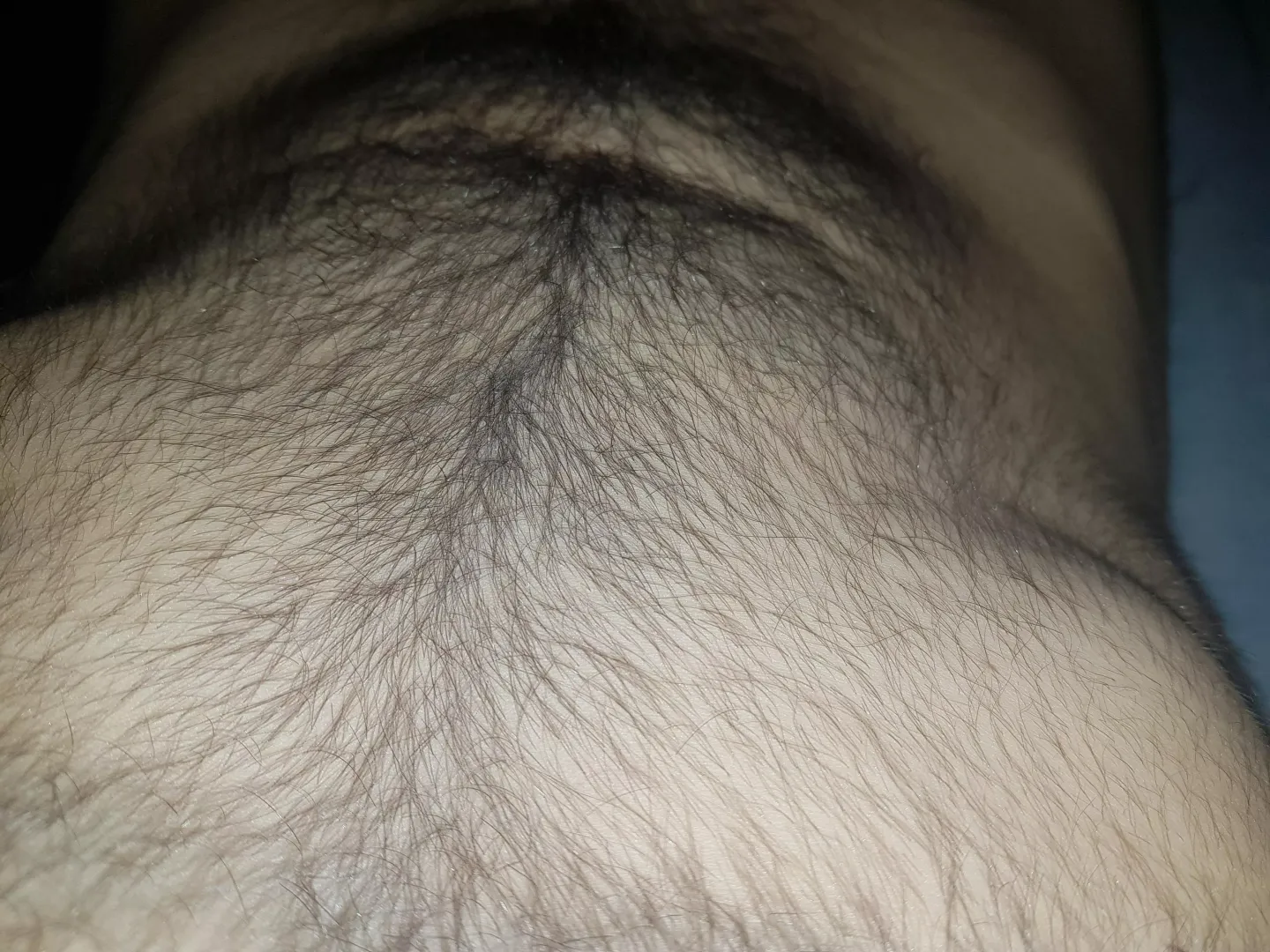 is this hairy enough? (18)