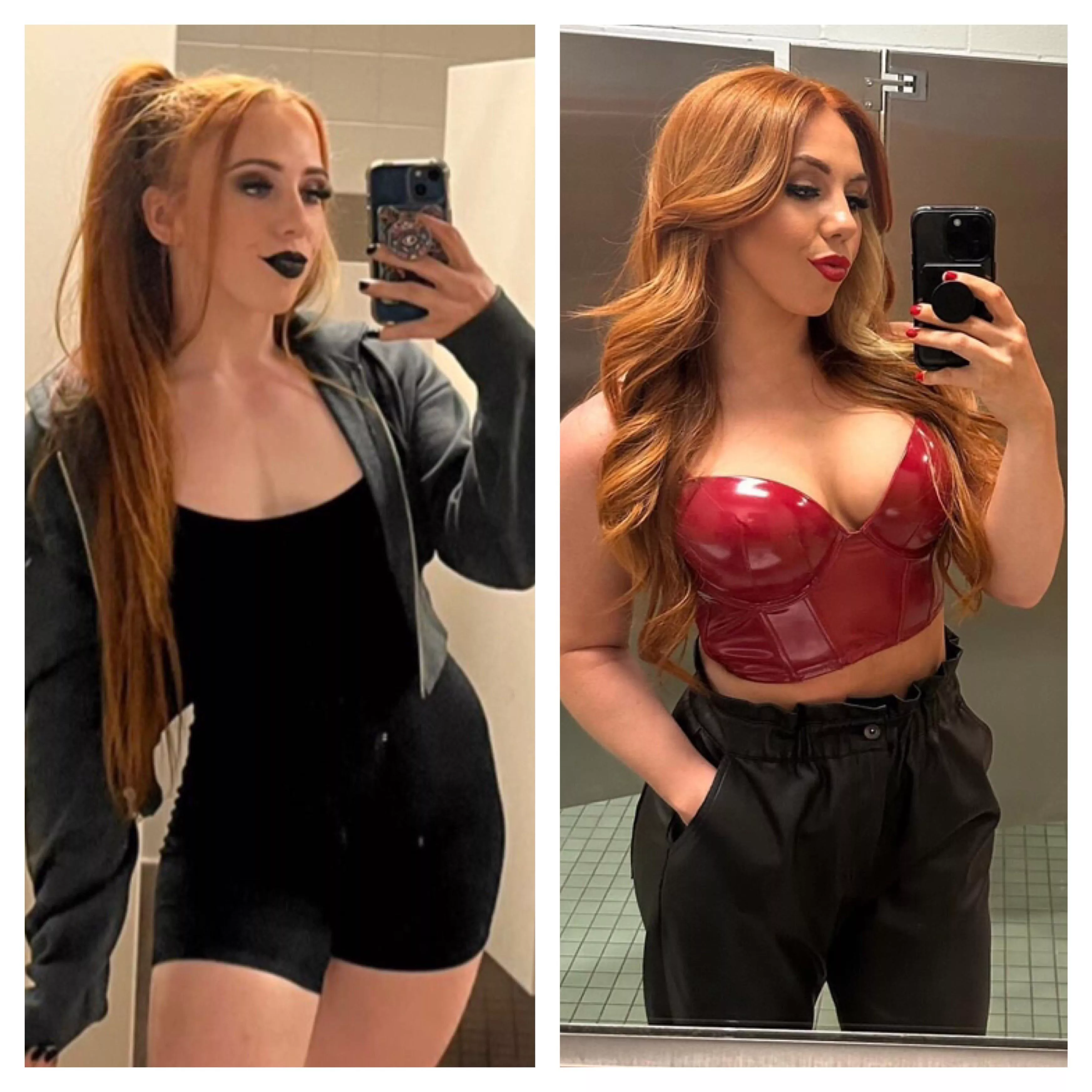 Isla Dawn Before/After Boob Job