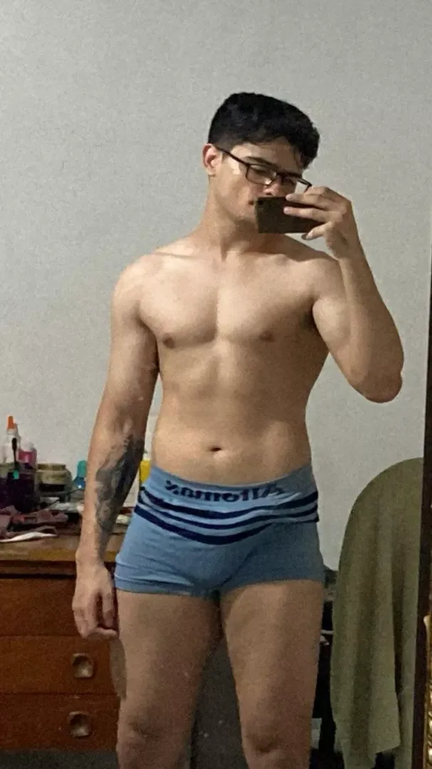 It doesnt look like but my arm is in pain [M]
