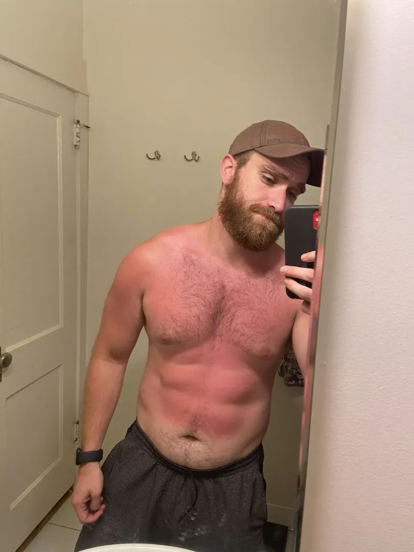 It’s not too late to get a sunburn