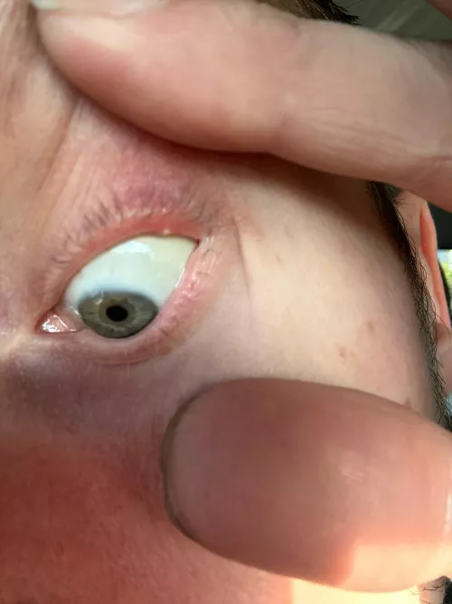 It’s on my eyeeeeeee