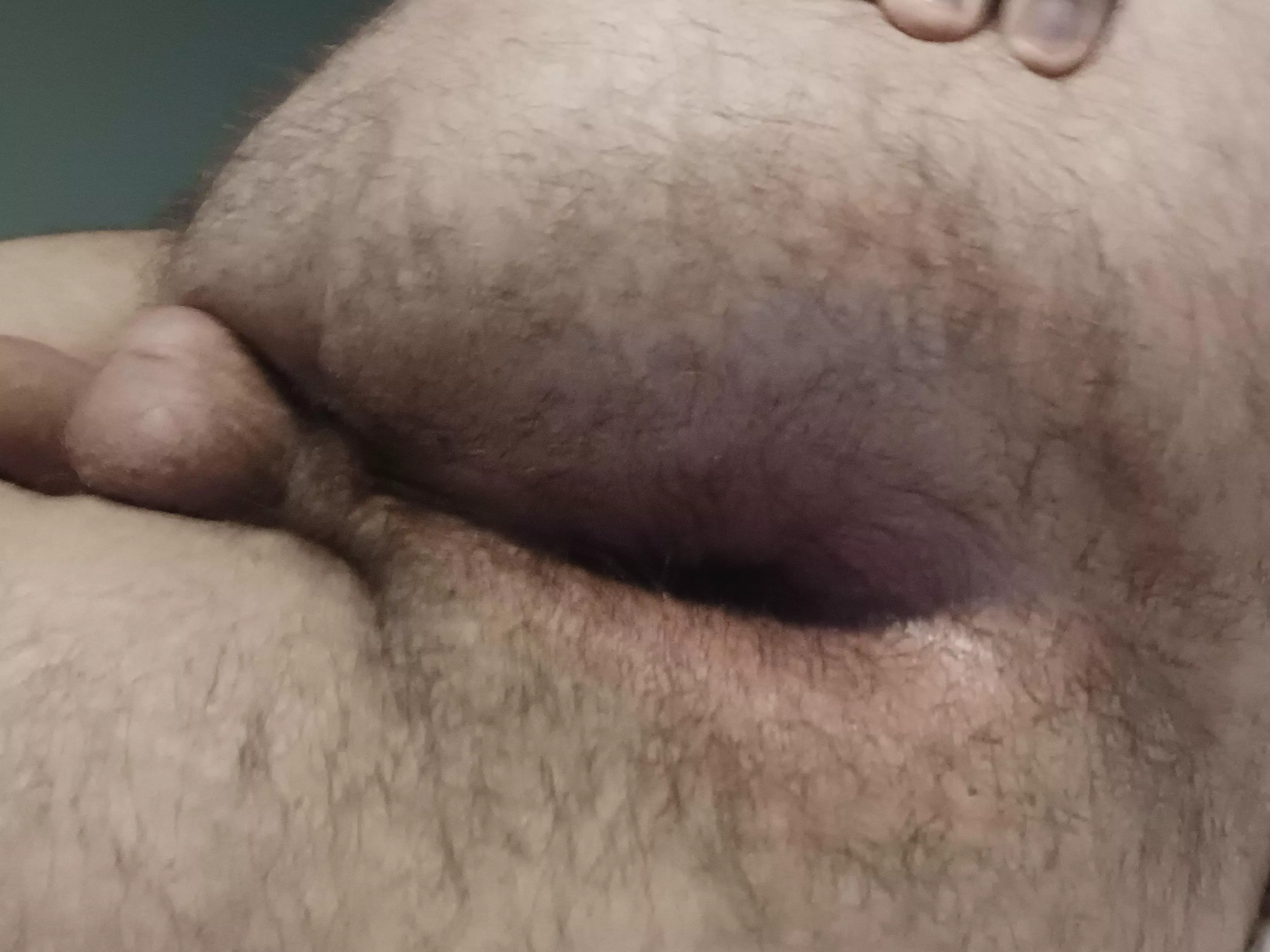 I've got an itch I need someone scratch.