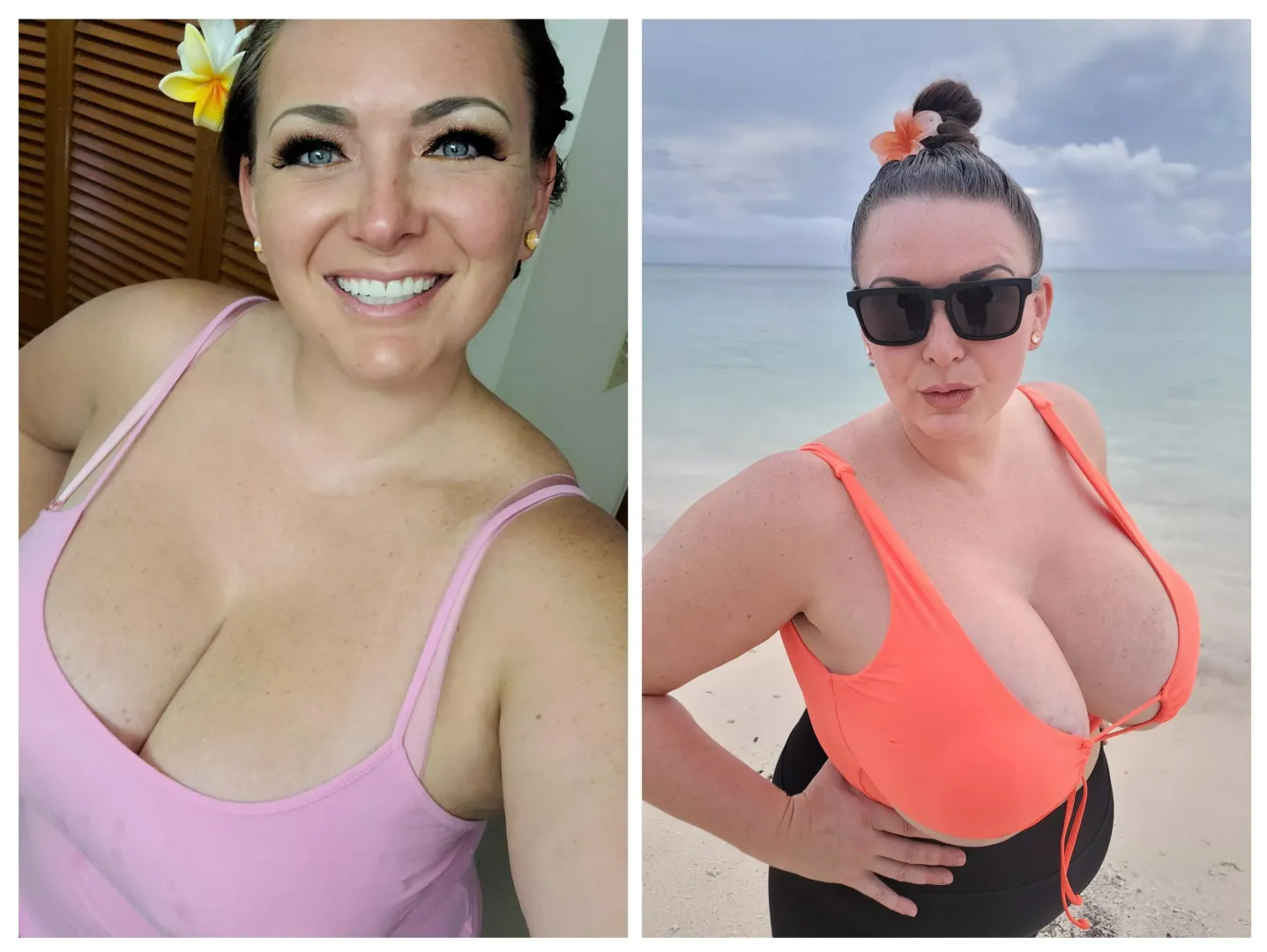 Just 1 year worth of breast growth.