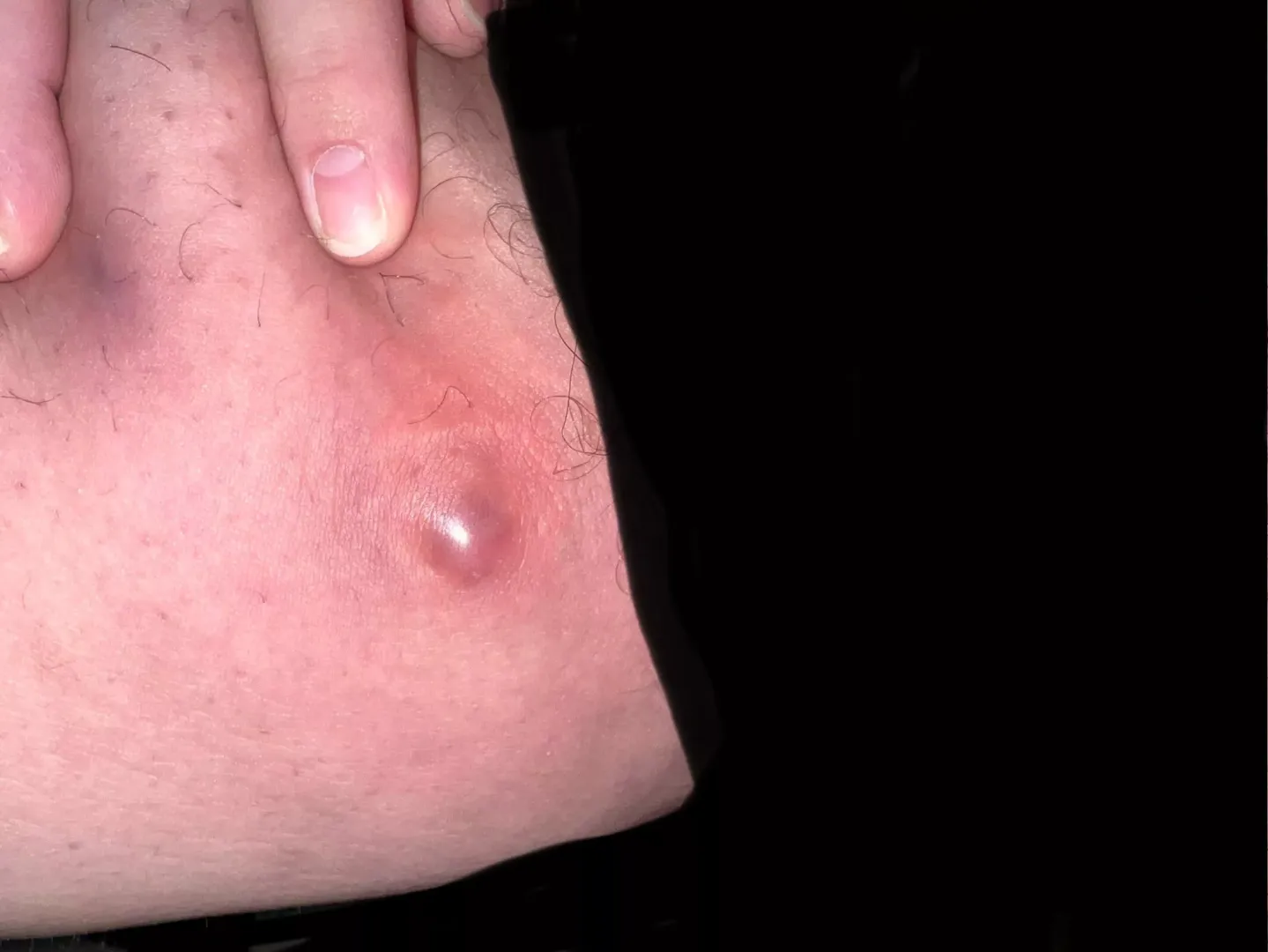 Just fucking pop already