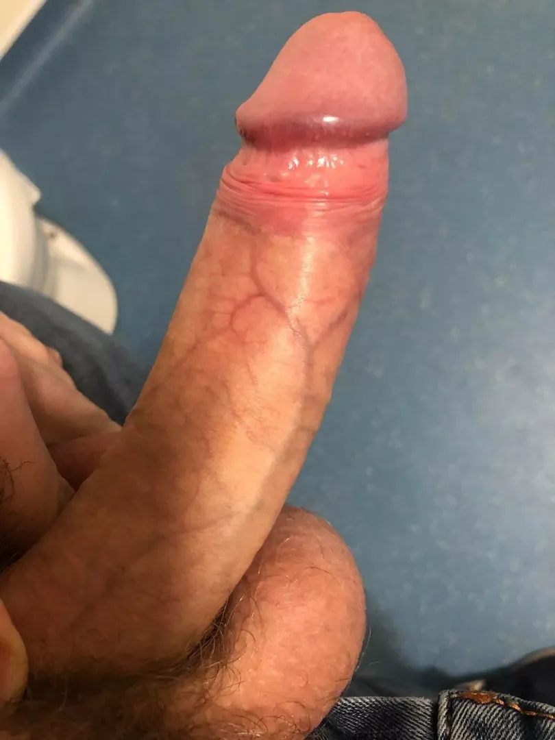 Just want some honest options on it