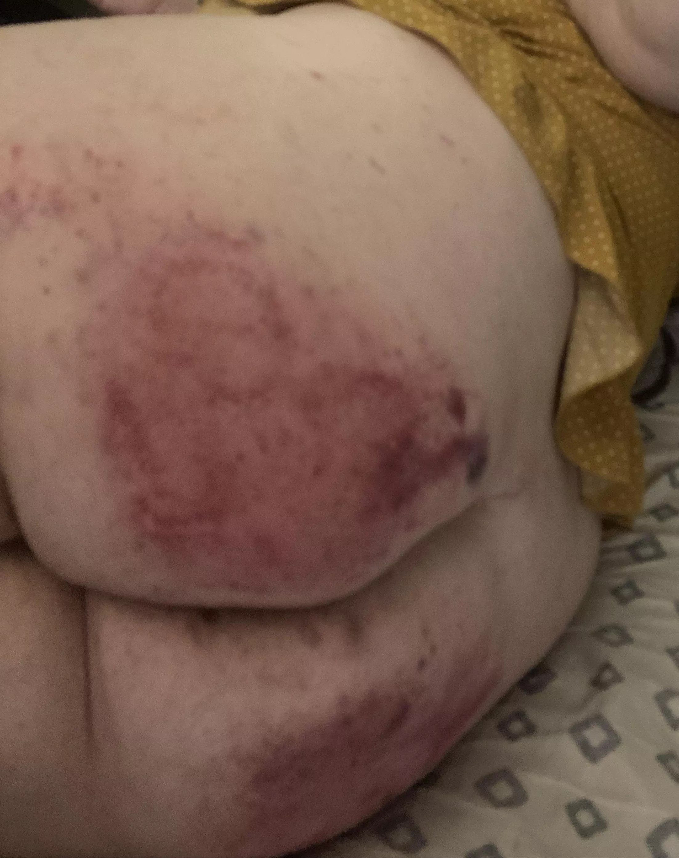 Killer spanking