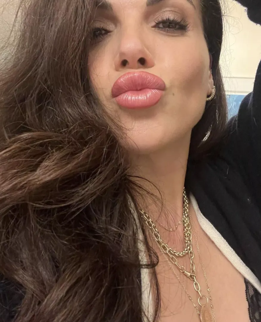 Kisses