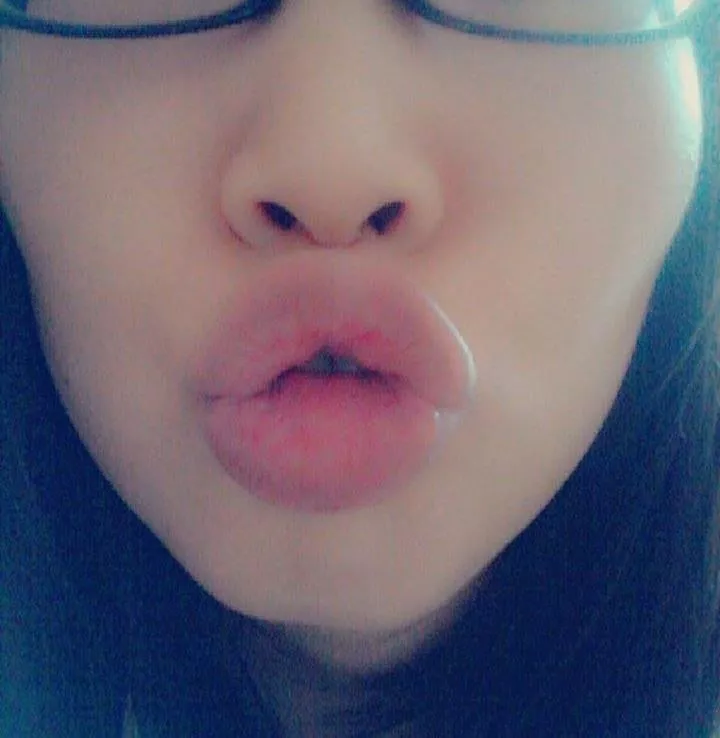 Kisssssd