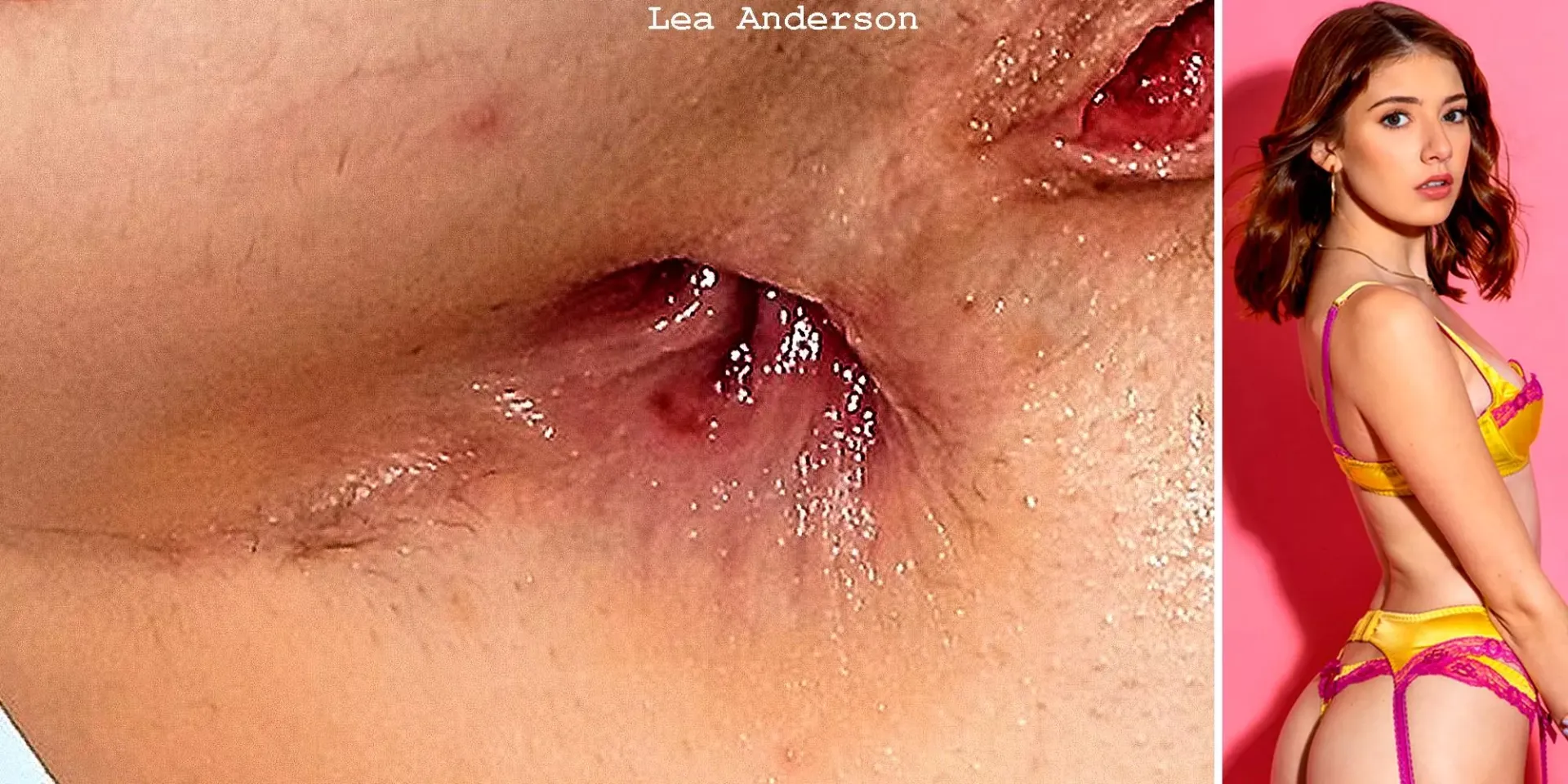Lea Anderson - still burning