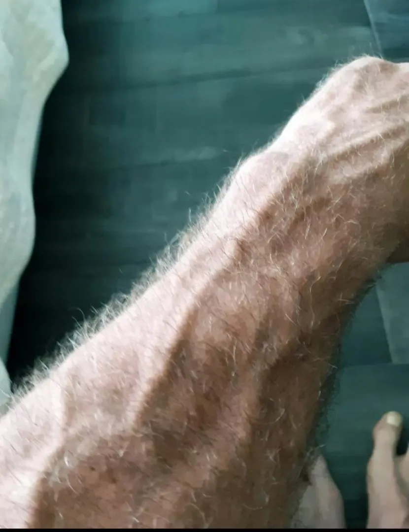 left arm