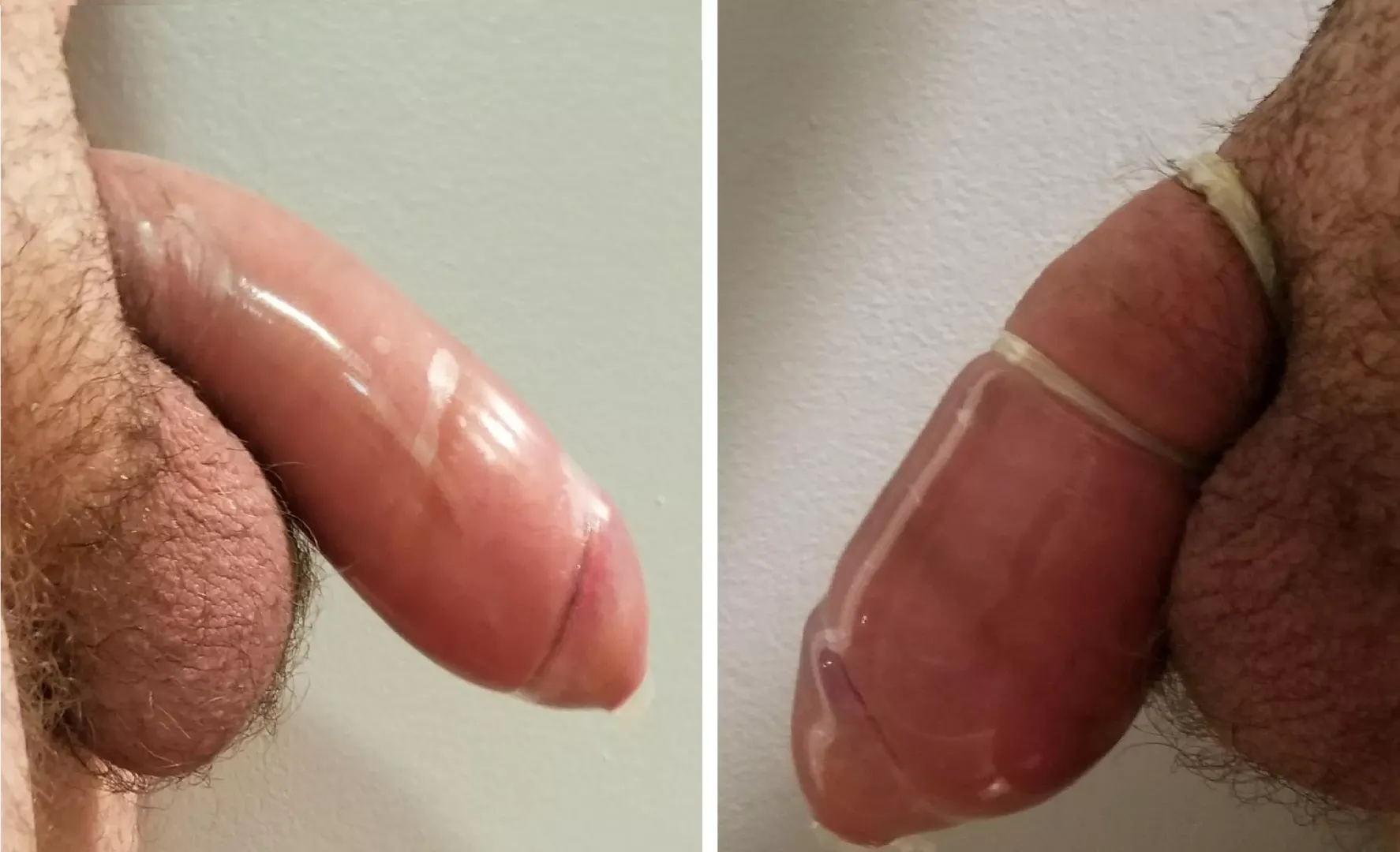 Left or right