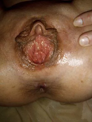 Like my side piece?
