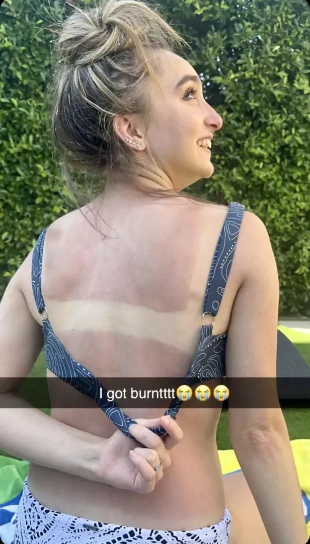 Lil burnt
