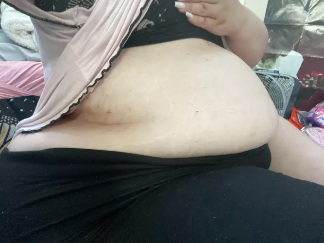 Look at those stretch marks!