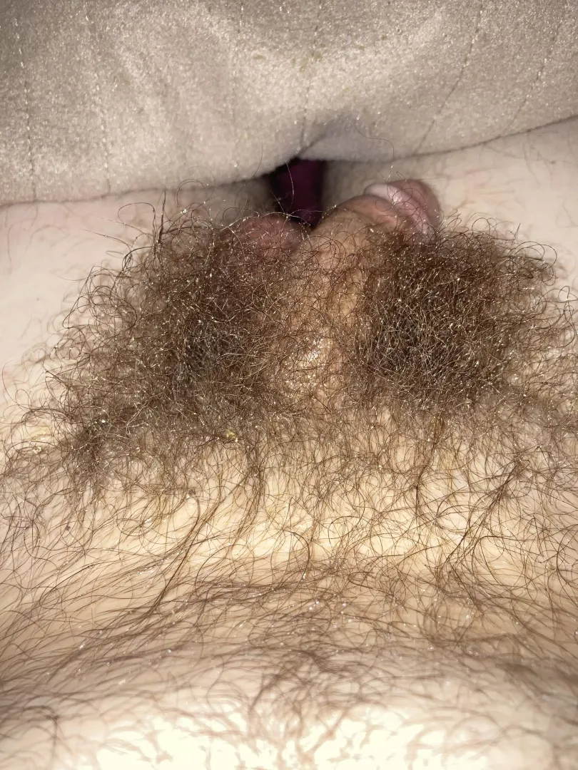Lotta hair