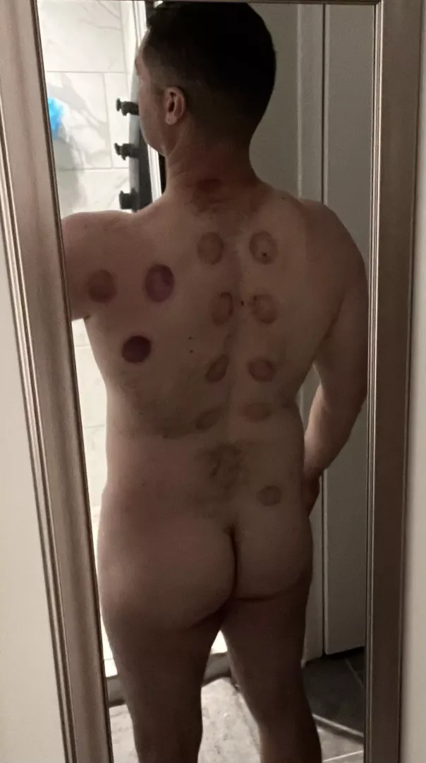 (M) 42, 215, 6 Any one else try? What was your experience?