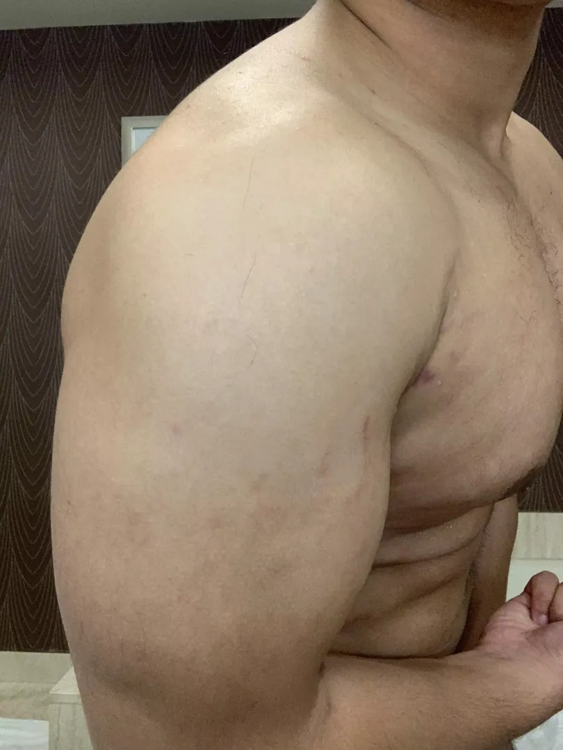 [m] Arm day