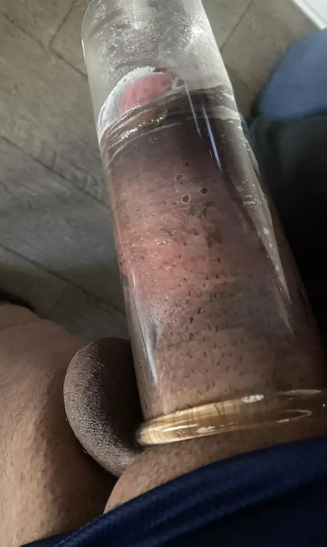 Massive girth