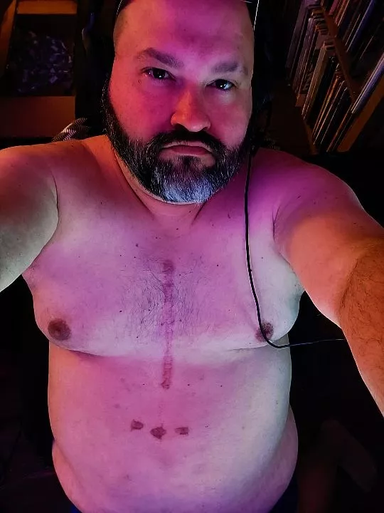 Me scars and all