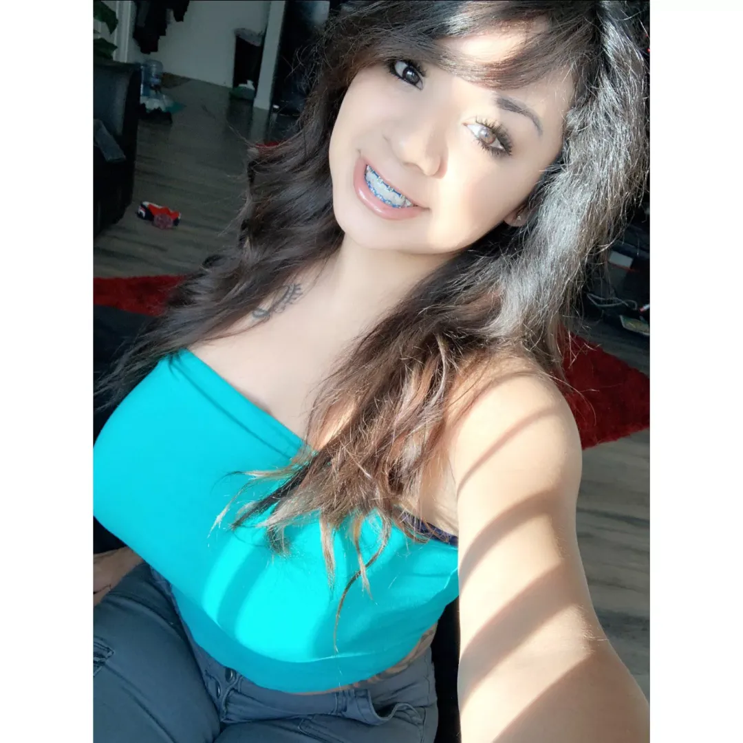 More Braces