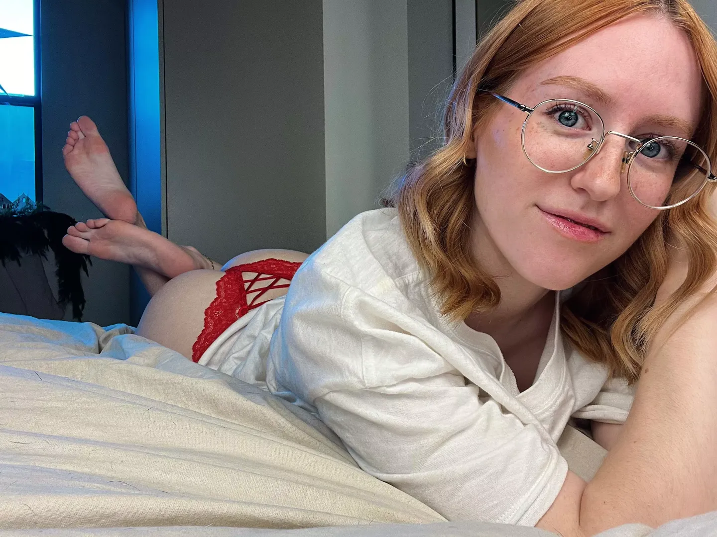 More freckles, more fun [IRTR]