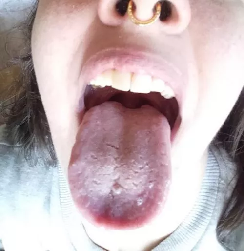more open?
