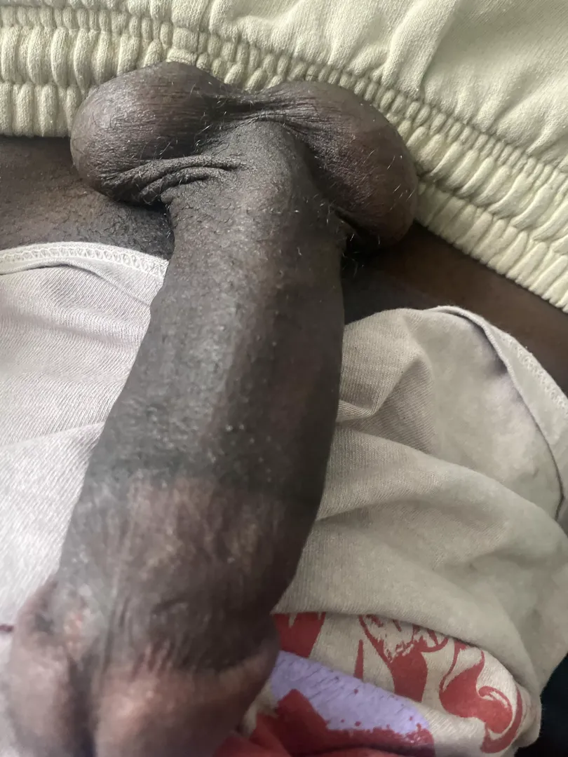 Morning wood