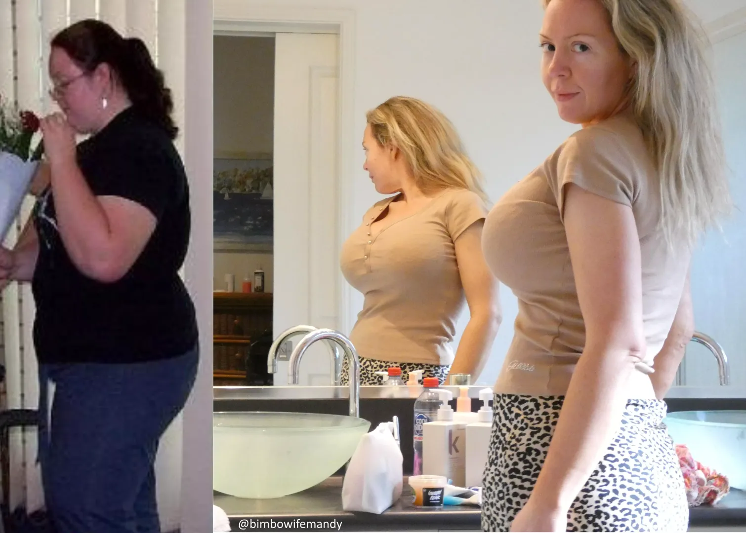 My (37F) bimbofication journey - Weight loss, 1650cc breast implants, lip fillers, etc - I think my body line is looking pretty good these days?