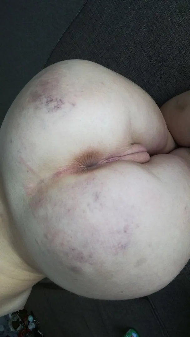 My ass kinda hurts