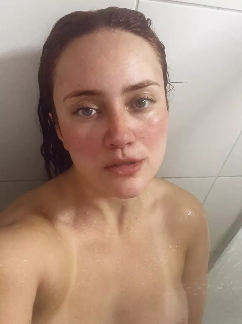 My eyes are up here. My freckles are everywhere
