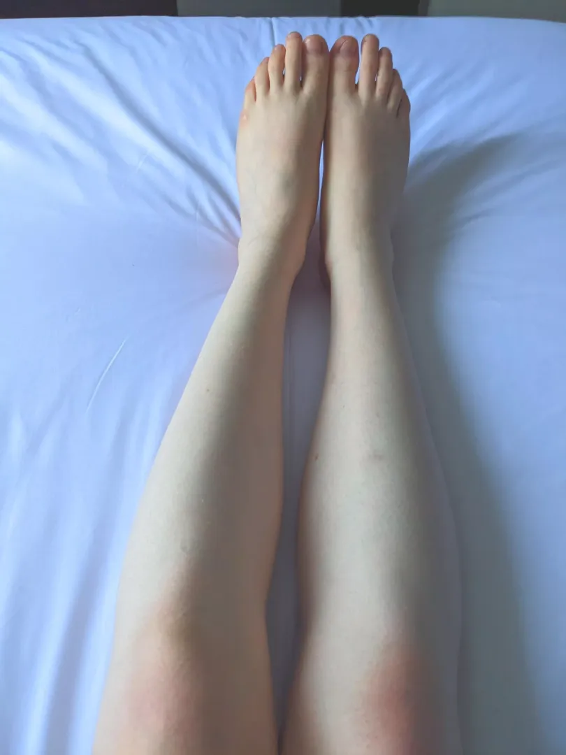 My feet and legs!!