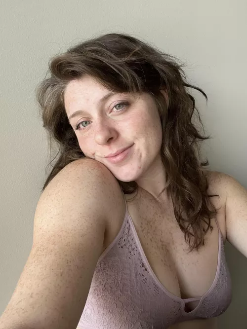 My freckles