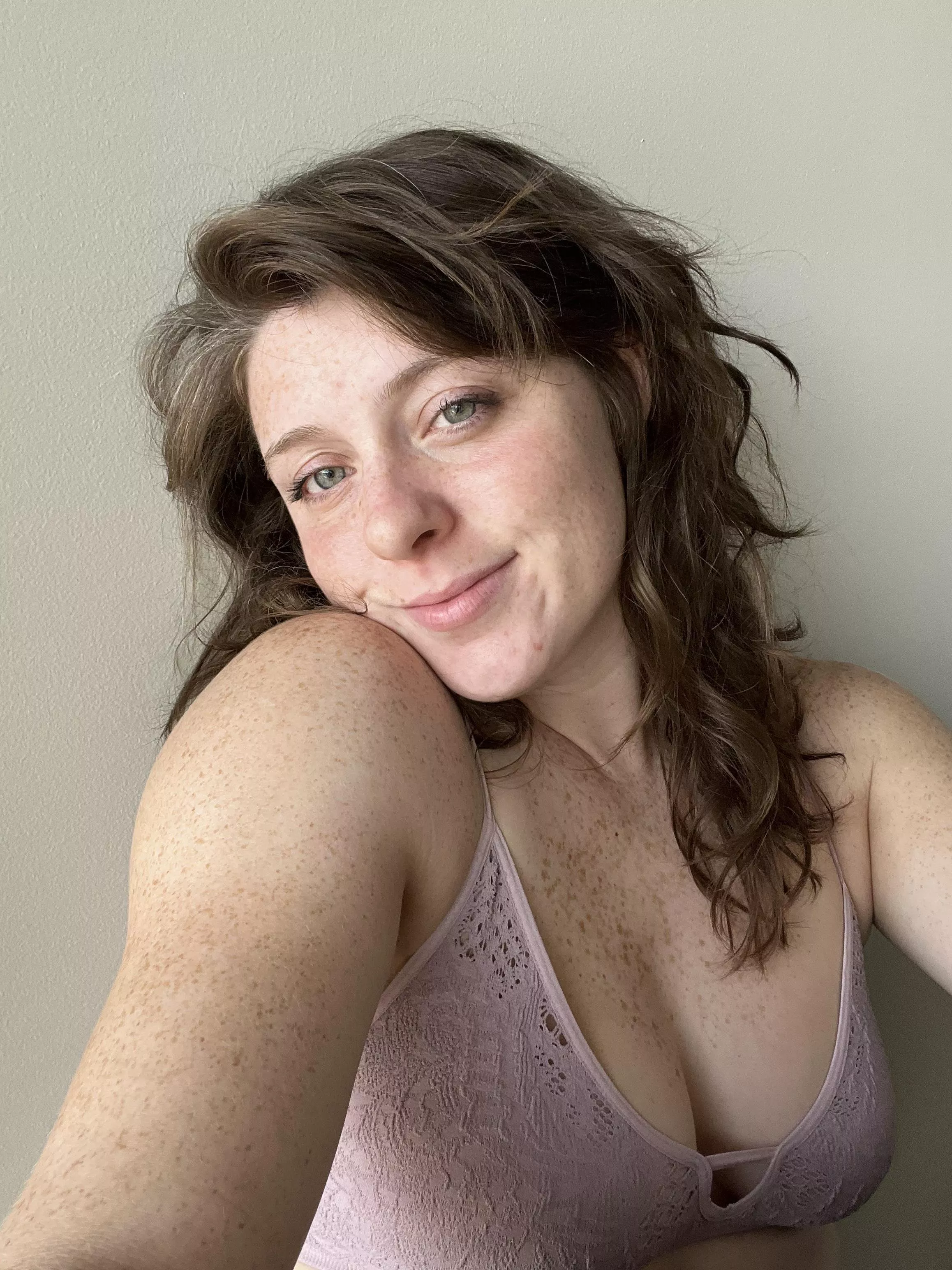 My freckles
