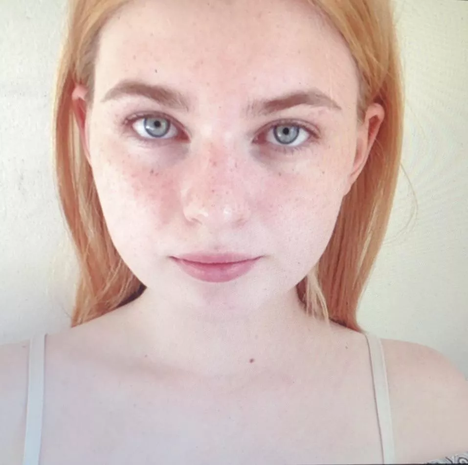 My friends dad said I looked too pale… does he not understand that I’m ginger??