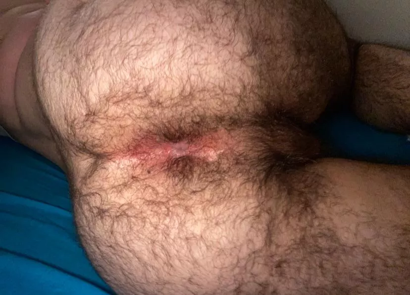 My hairy ass. What do you think?