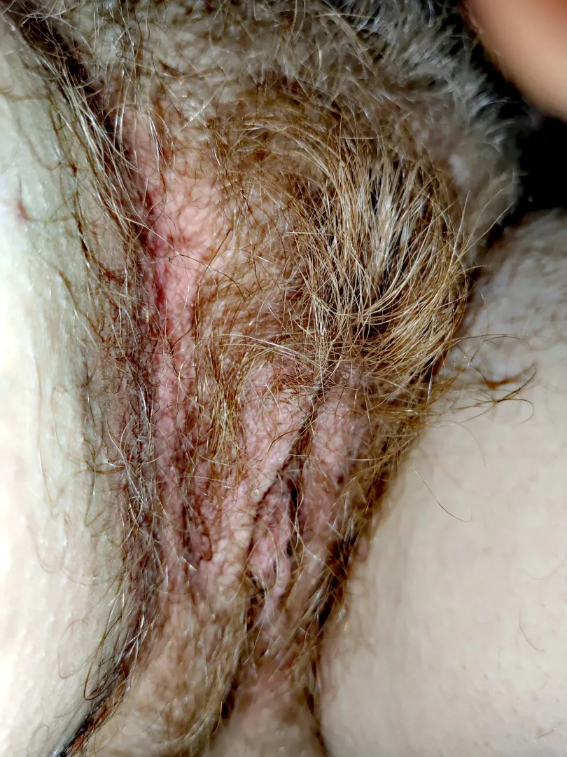 My hairy treasure 