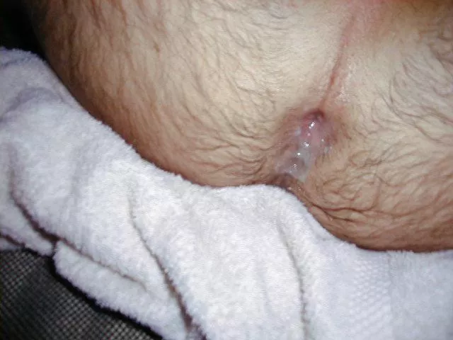 My hole after a breeding