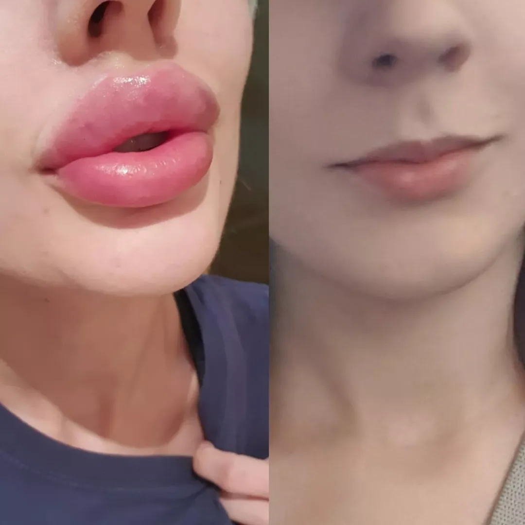 my lips want a kiss 💋🌹 do you like them? 8cc❤️‍🔥