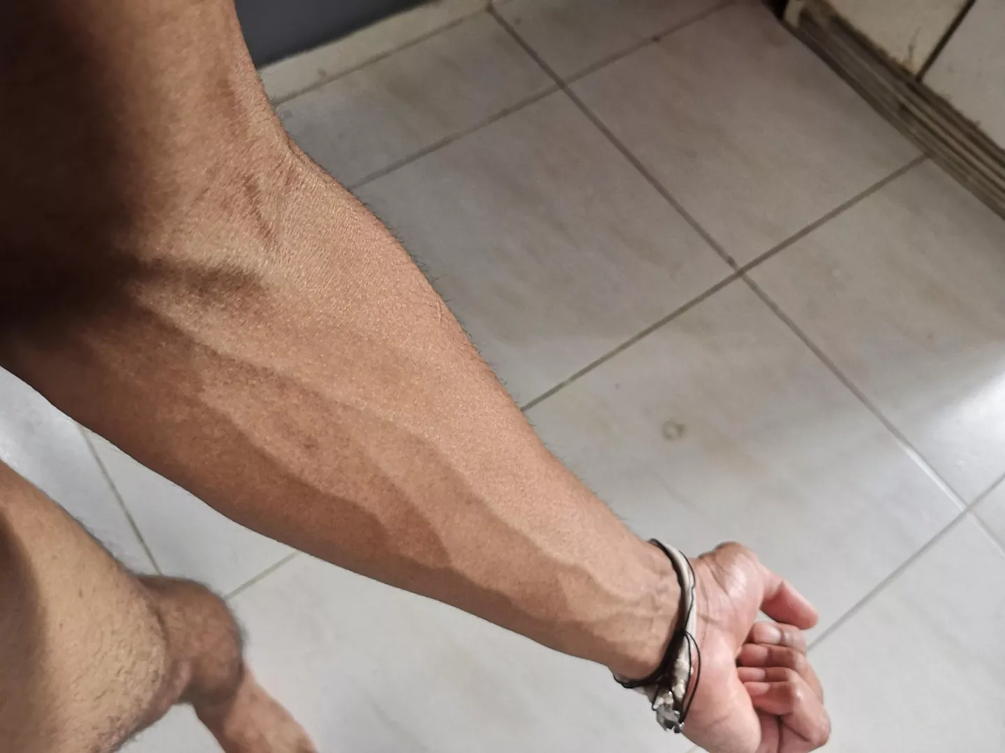 my pretty forearm
