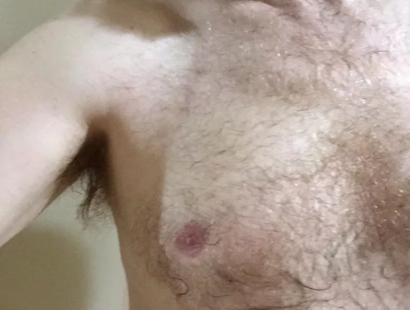 My untrimmed pit