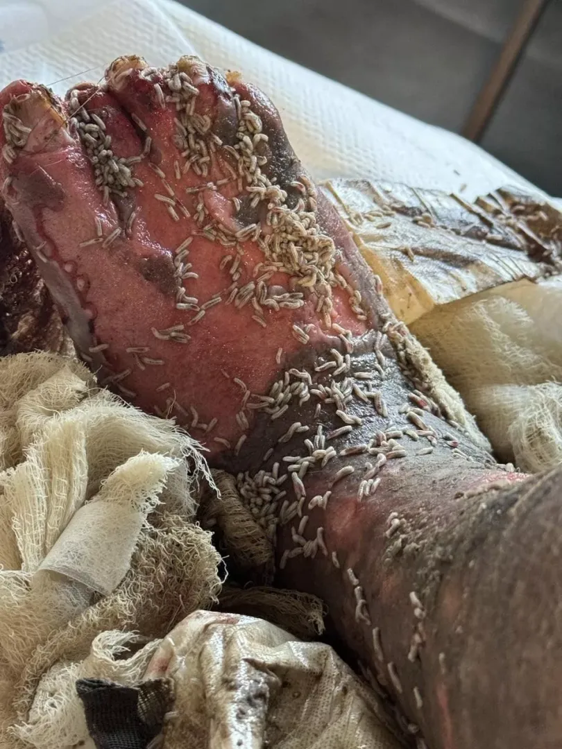 Nasty ass foot